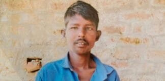 नांदेड शासकीय रुग्णालयात रुग्णाचे डुकरांनी लचके तोडले.